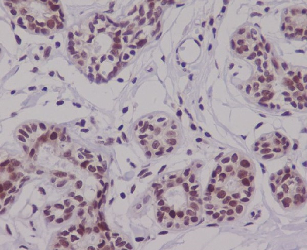 2 - Anti-p63 TP63 Rabbit Monoclonal Antibody ABO13256