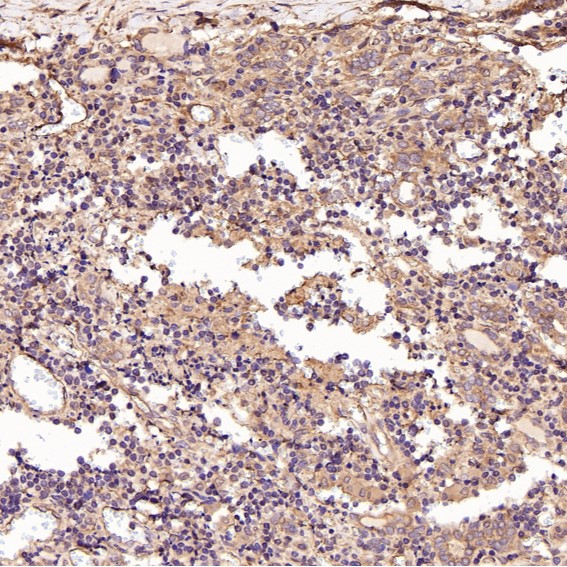 2 - Anti-p63 TP63 Rabbit Monoclonal Antibody ABO13256