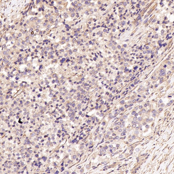 2 - Anti-p63 TP63 Rabbit Monoclonal Antibody ABO13256