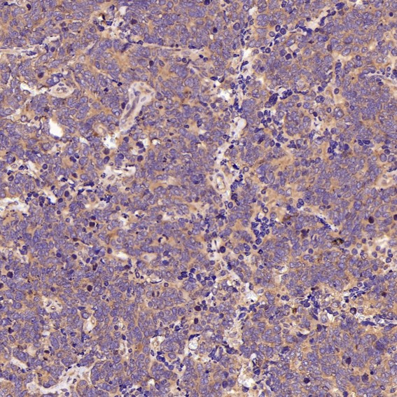 2 - Anti-p63 TP63 Rabbit Monoclonal Antibody ABO13256