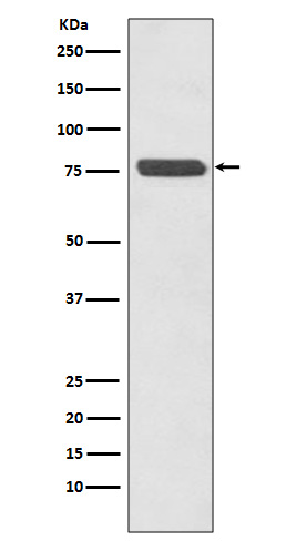 1 - Anti-p63 TP63 Rabbit Monoclonal Antibody ABO13256