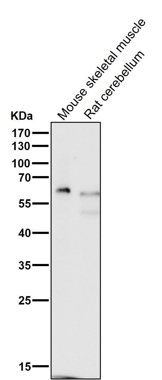 1 - Anti-p63 TP63 Rabbit Monoclonal Antibody ABO13256