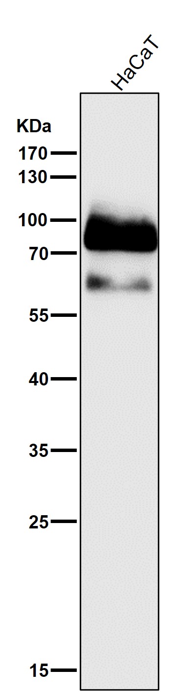1 - Anti-p63 TP63 Rabbit Monoclonal Antibody ABO13256