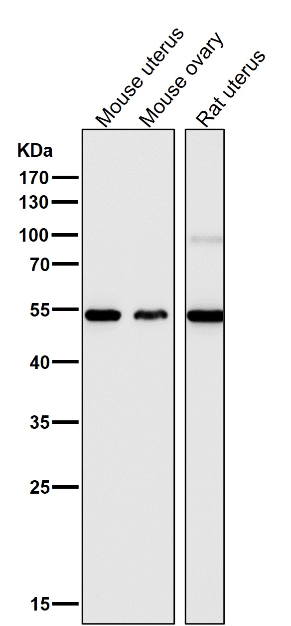 1 - Anti-p63 TP63 Rabbit Monoclonal Antibody ABO13256