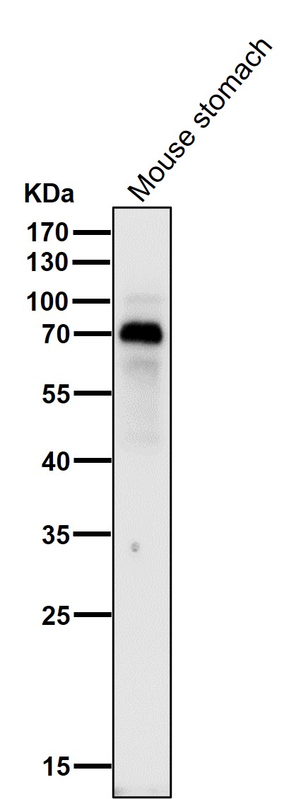 1 - Anti-p63 TP63 Rabbit Monoclonal Antibody ABO13256
