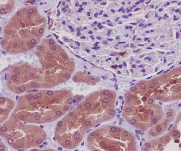 2 - Anti-PKR EIF2AK2 Rabbit Monoclonal Antibody ABO13257