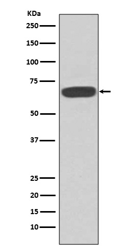 1 - Anti-PKR EIF2AK2 Rabbit Monoclonal Antibody ABO13257