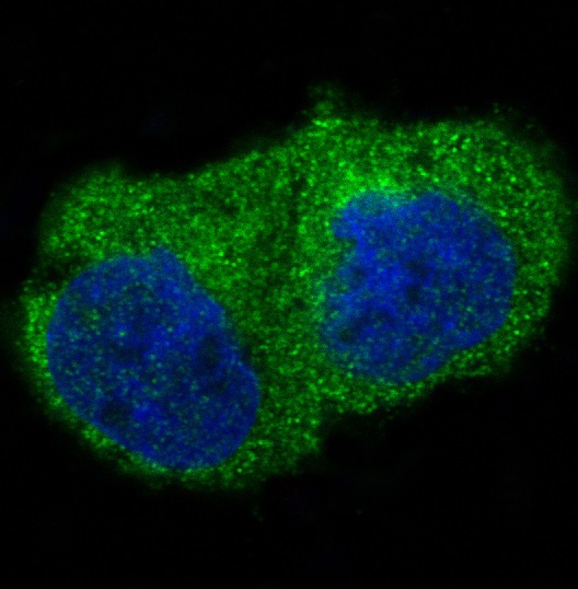 3 - Anti-ILK/Integrin Linked Ilk Rabbit Monoclonal Antibody ABO13259