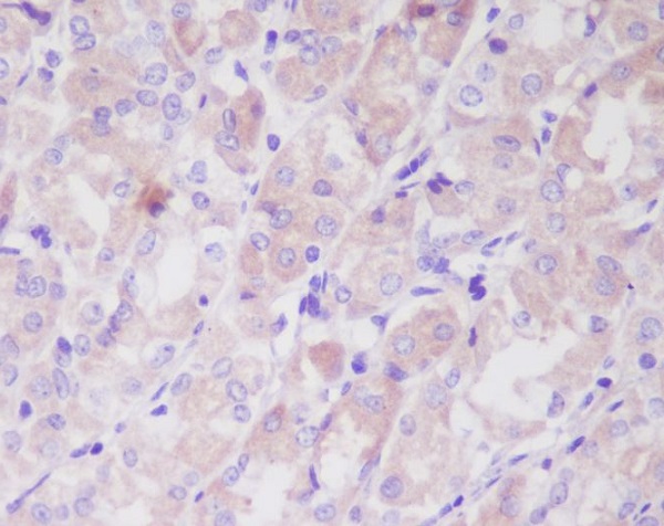 2 - Anti-ILK/Integrin Linked Ilk Rabbit Monoclonal Antibody ABO13259