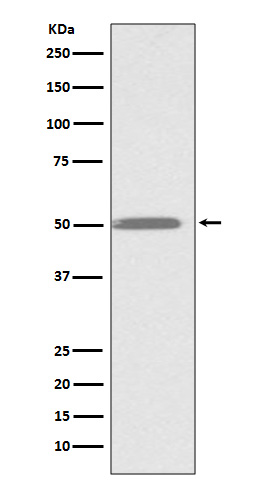 1 - Anti-ILK/Integrin Linked Ilk Rabbit Monoclonal Antibody ABO13259