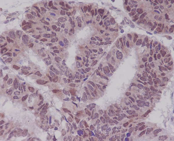 2 - Anti-BTK Rabbit Monoclonal Antibody ABO13261