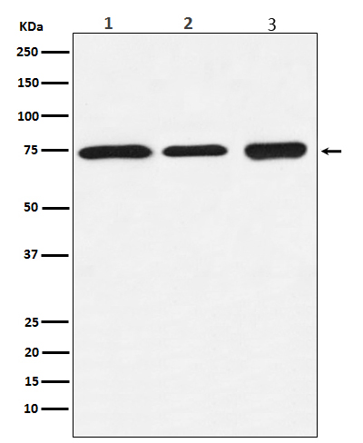 1 - Anti-BTK Rabbit Monoclonal Antibody ABO13261