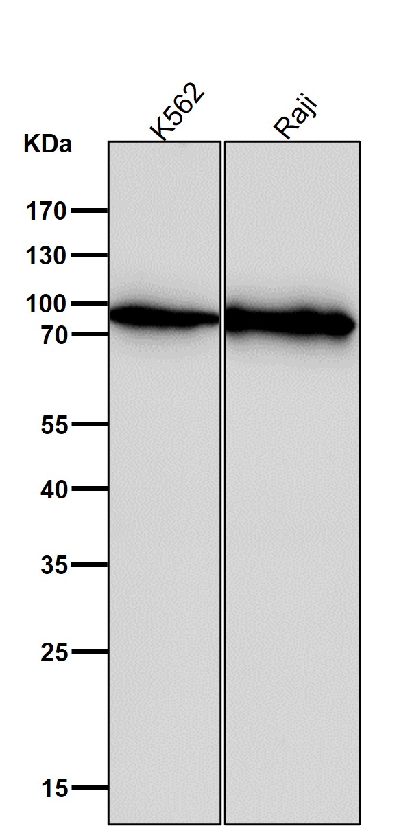 1 - Anti-BTK Rabbit Monoclonal Antibody ABO13261