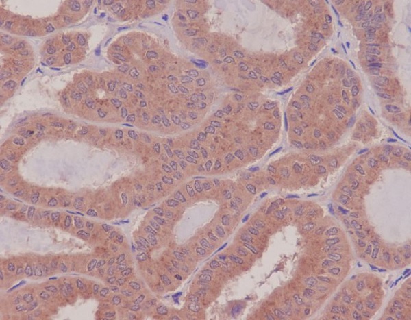 2 - Anti-Rho RHOA Rabbit Monoclonal Antibody ABO13262