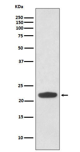 1 - Anti-Rho RHOA Rabbit Monoclonal Antibody ABO13262