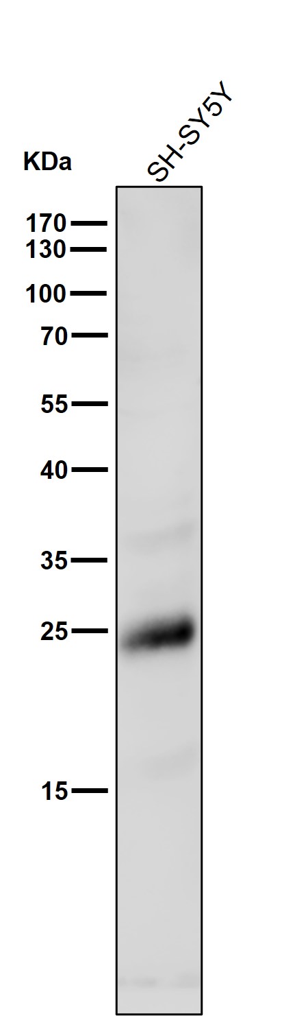 1 - Anti-Rho RHOA Rabbit Monoclonal Antibody ABO13262
