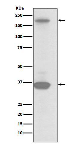 1 - Anti-RON Rabbit Monoclonal Antibody ABO13263