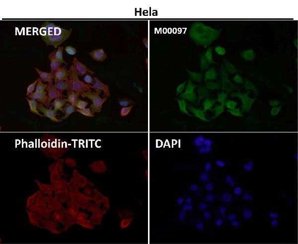 1 - Anti-Tau MAPT Rabbit Monoclonal Antibody ABO13264