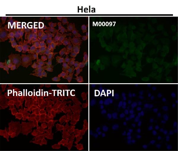 1 - Anti-Tau MAPT Rabbit Monoclonal Antibody ABO13264