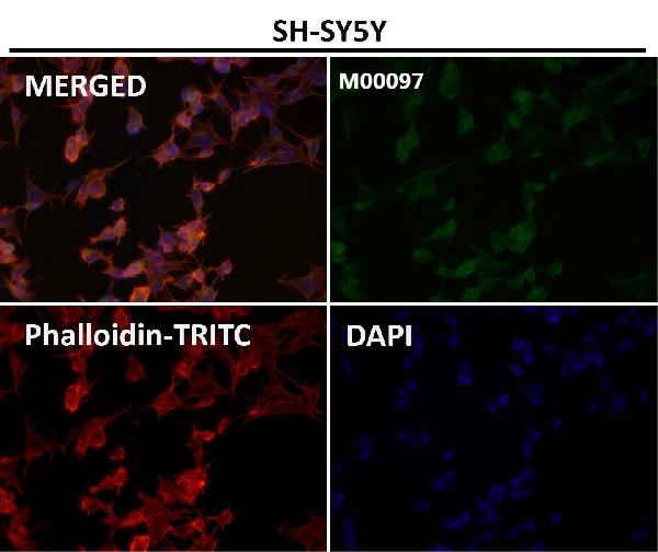 1 - Anti-Tau MAPT Rabbit Monoclonal Antibody ABO13264