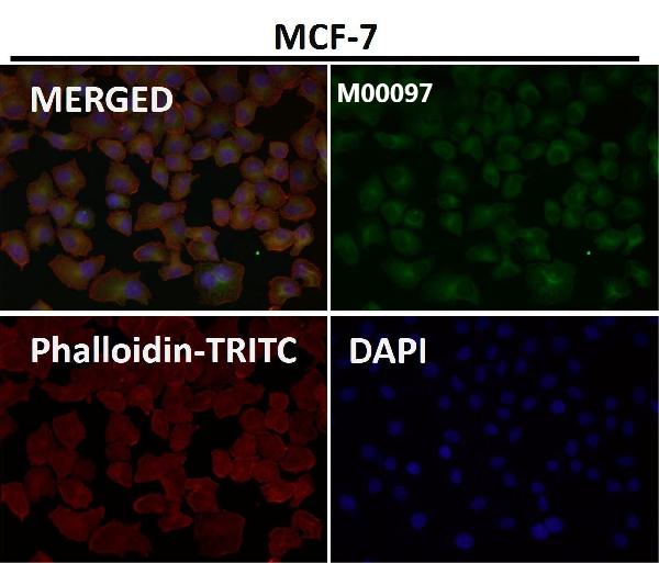 1 - Anti-Tau MAPT Rabbit Monoclonal Antibody ABO13264