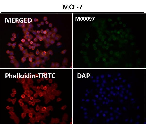 1 - Anti-Tau MAPT Rabbit Monoclonal Antibody ABO13264