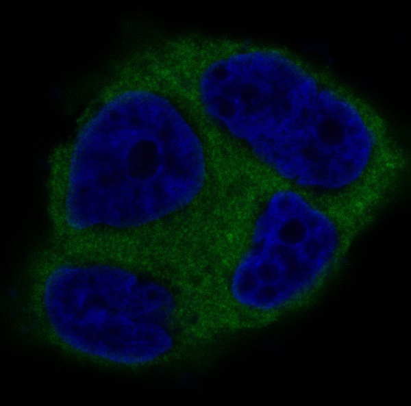 3 - Anti-Tau MAPT Rabbit Monoclonal Antibody ABO13264