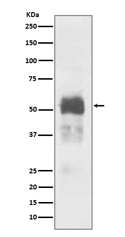 1 - Anti-Tau MAPT Rabbit Monoclonal Antibody ABO13264