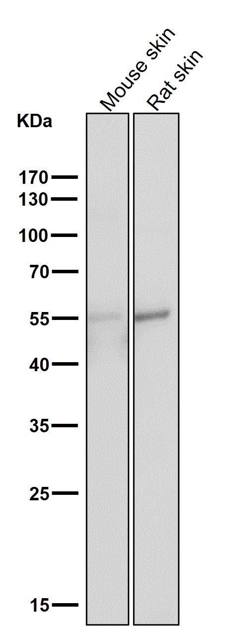 1 - Anti-Tau MAPT Rabbit Monoclonal Antibody ABO13264