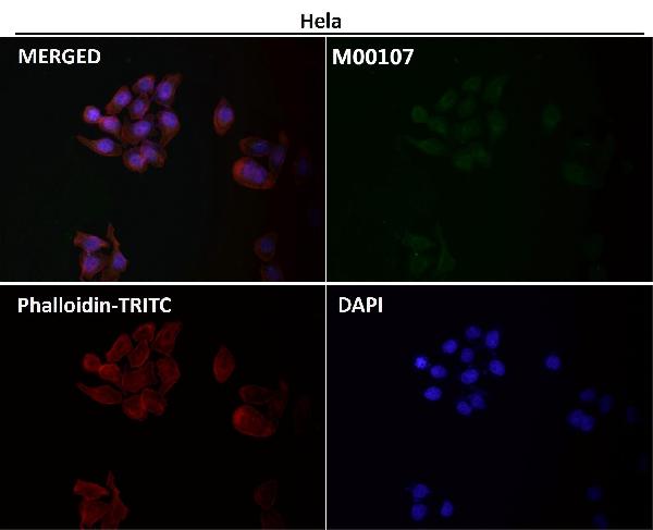 1 - Anti-Src Rabbit Monoclonal Antibody ABO13268