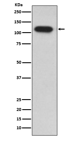 1 - Anti-IDE/Insulysin Rabbit Monoclonal Antibody ABO13269