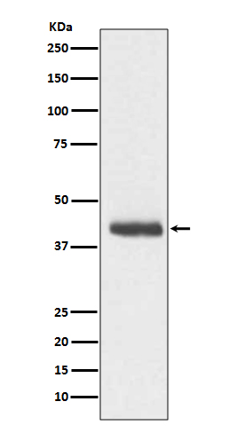 1 - Anti-DCX/Doublecortin Rabbit Monoclonal Antibody ABO13271