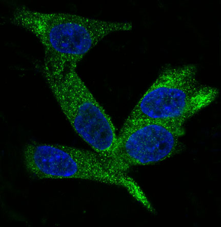 3 - Anti-HE4 WFDC2 Rabbit Monoclonal Antibody ABO13272