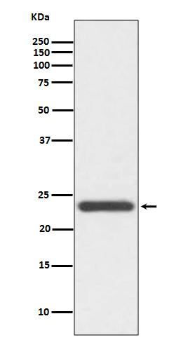 1 - Anti-HE4 WFDC2 Rabbit Monoclonal Antibody ABO13272
