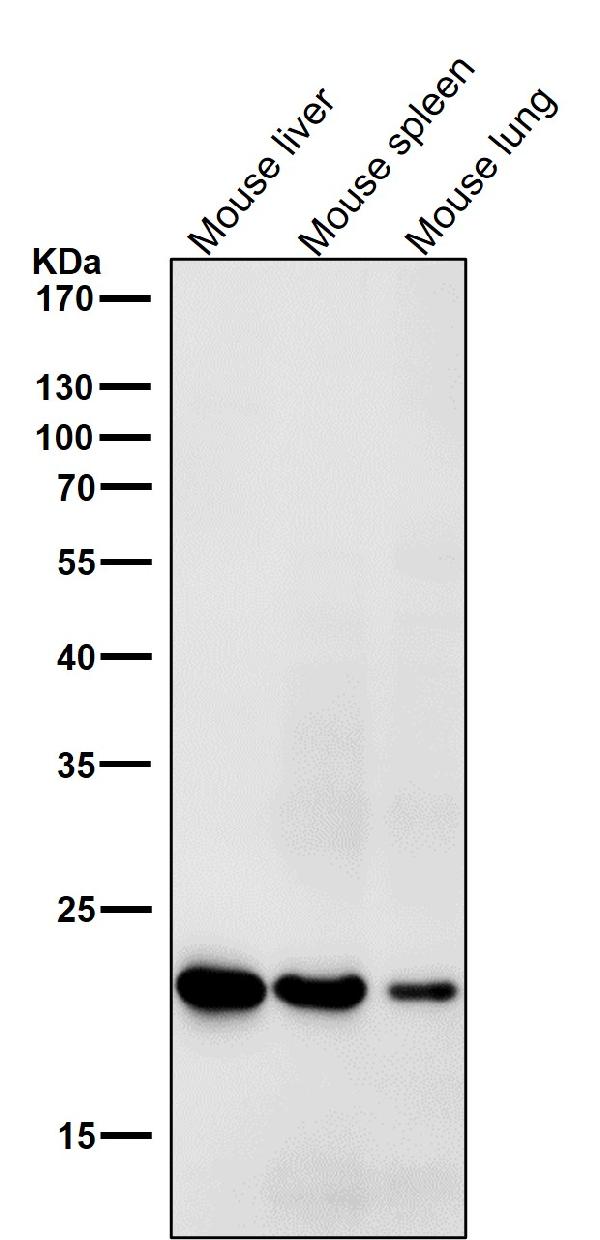 1 - Anti-HE4 WFDC2 Rabbit Monoclonal Antibody ABO13272