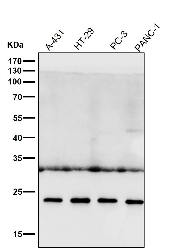 1 - Anti-HE4 WFDC2 Rabbit Monoclonal Antibody ABO13272