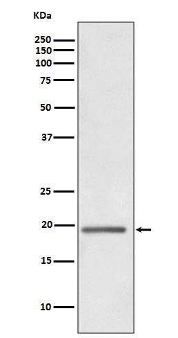 1 - Anti-HE4 WFDC2 Rabbit Monoclonal Antibody ABO13274