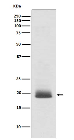 1 - Anti-Ras NRAS Rabbit Monoclonal Antibody ABO13275