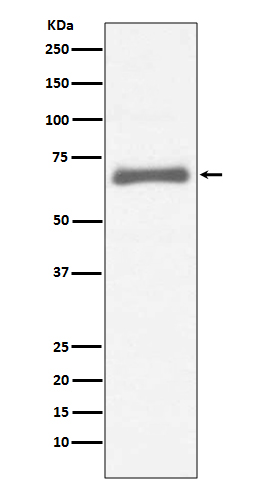 1 - Anti-AFP/Alpha 1 Fetoprotein Rabbit Monoclonal Antibody ABO13279