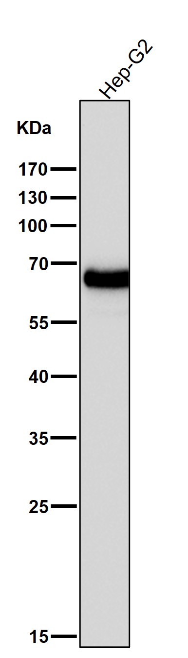 1 - Anti-AFP/Alpha 1 Fetoprotein Rabbit Monoclonal Antibody ABO13279