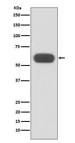 1 - Anti-GBA/Glucosylceramidase Rabbit Monoclonal Antibody ABO13280