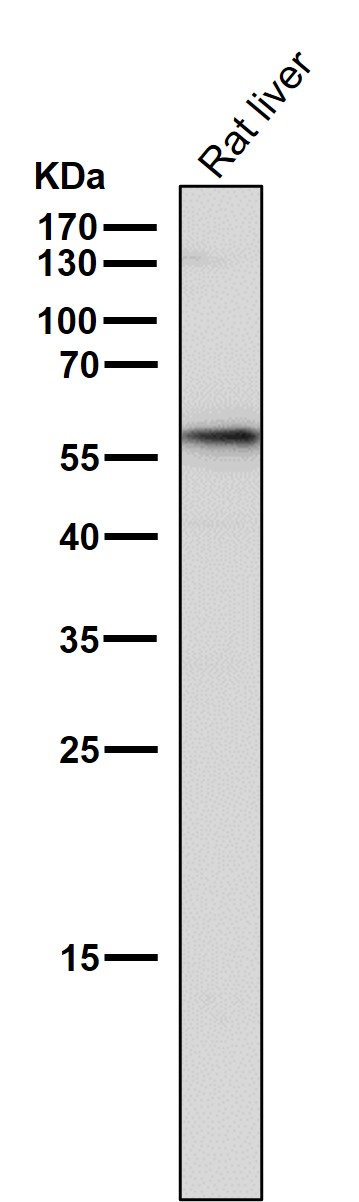 1 - Anti-GBA/Glucosylceramidase Rabbit Monoclonal Antibody ABO13280