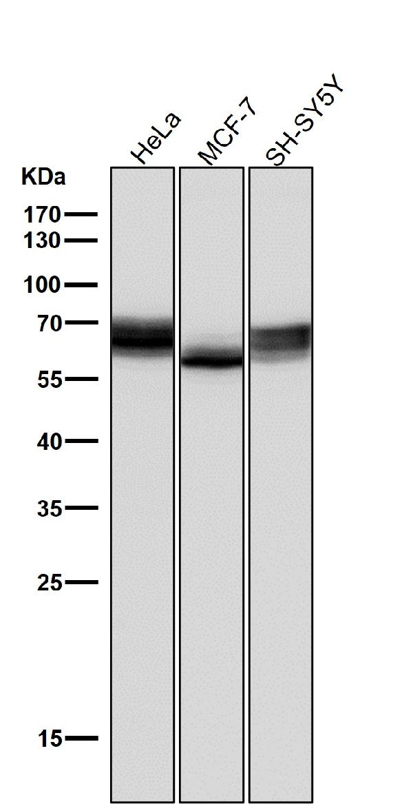 1 - Anti-GBA/Glucosylceramidase Rabbit Monoclonal Antibody ABO13280