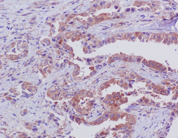 2 - Anti-Bid Rabbit Monoclonal Antibody ABO13282