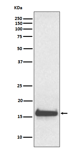 1 - Anti-TTR/Prealbumin Rabbit Monoclonal Antibody ABO13284