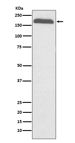 1 - Anti-A2M/Alpha 2 Macroglobulin Rabbit Monoclonal Antibody ABO13286