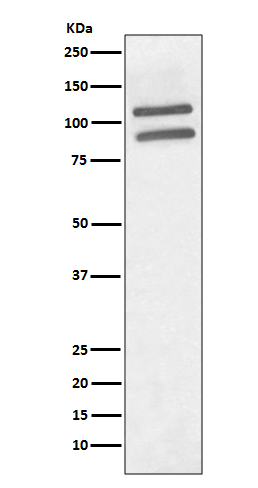 1 - Anti-PML Rabbit Monoclonal Antibody ABO13287