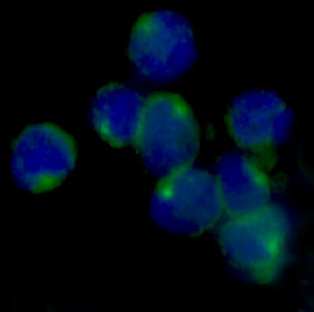 3 - Anti-LOX Rabbit Monoclonal Antibody ABO13289
