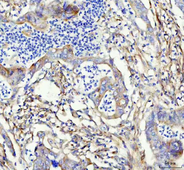 2 - Anti-LOX Rabbit Monoclonal Antibody ABO13289