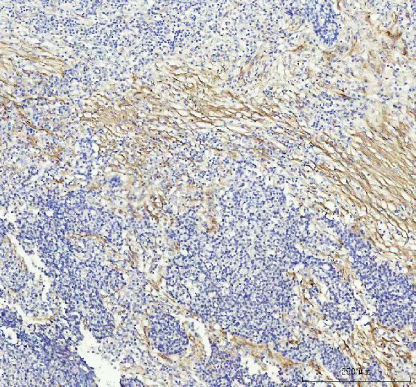 2 - Anti-LOX Rabbit Monoclonal Antibody ABO13289